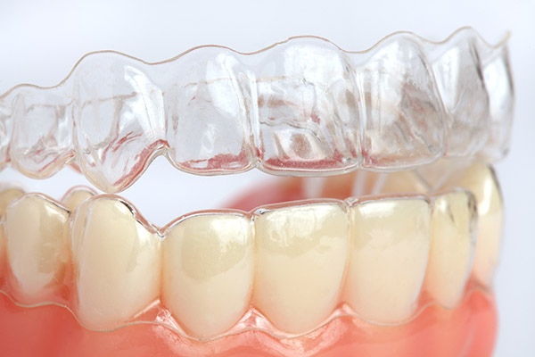 Invisalign Options To Have Straight Teeth Fast